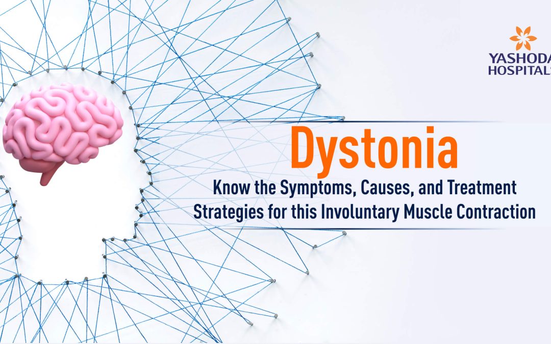 Dystonia: Know the Symptoms, Causes, and Treatment Strategies for this Involuntary Muscle Contraction