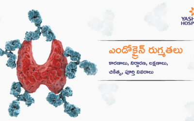 ఎండోక్రైన్ రుగ్మతలు: కారణాలు, నిర్దారణ, లక్షణాలు, చికిత్స, పూర్తి వివరాలు