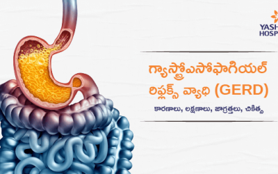 గ్యాస్ట్రోఎసోఫాగియల్ రిఫ్లక్స్ వ్యాధి (GERD) : కారణాలు, లక్షణాలు, జాగ్రత్తలు, చికిత్స