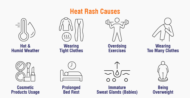 heat-rashes-causes