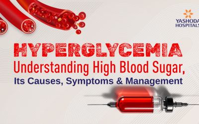 Hyperglycemia: Understanding High Blood Sugar, Its Causes, Symptoms & Management