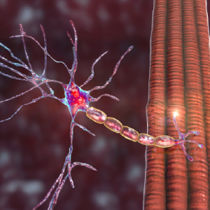 Duchenne Muscular Dystrophy