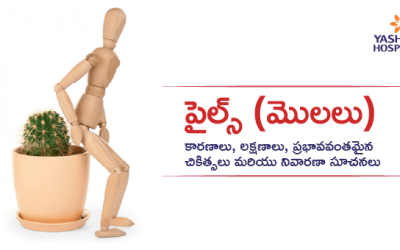 పైల్స్ (మొలలు): కారణాలు, లక్షణాలు, ప్రభావవంతమైన చికిత్సలు మరియు నివారణా సూచనలు