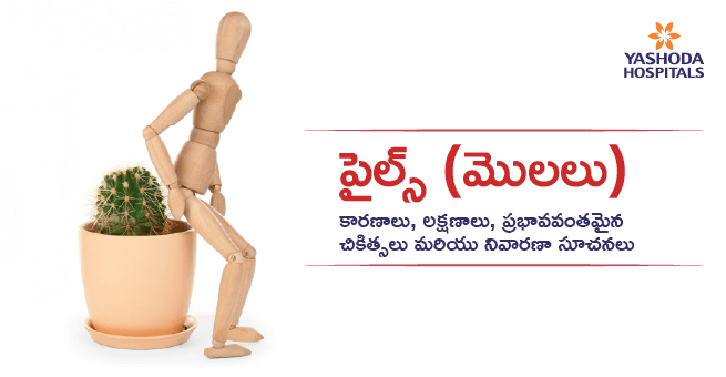 పైల్స్ (మొలలు): కారణాలు, లక్షణాలు, ప్రభావవంతమైన చికిత్సలు మరియు నివారణా సూచనలు