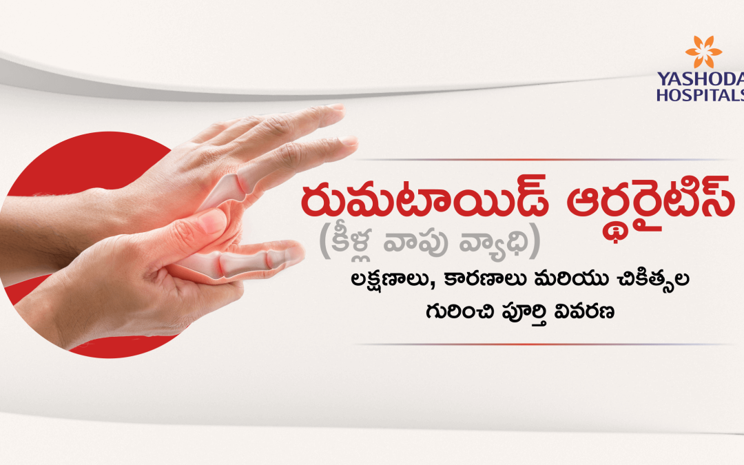 రుమటాయిడ్ ఆర్థరైటిస్ (కీళ్ల వాపు వ్యాధి) యొక్క లక్షణాలు, కారణాలు మరియు చికిత్సల గురించి పూర్తి వివరణ