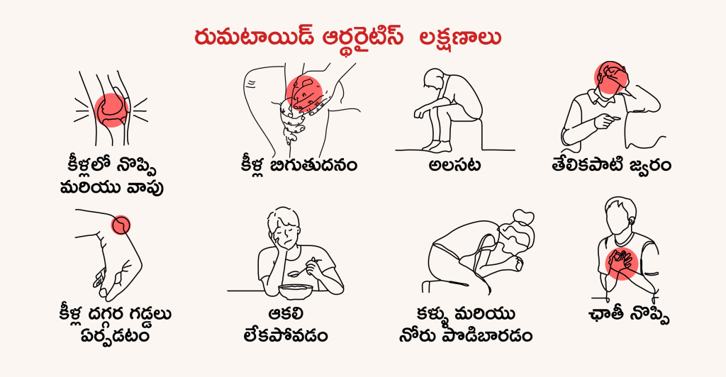 Rheumatoid arthritis