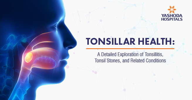 Tonsillar Health: A Detailed Exploration of Tonsillitis, Tonsil Stones, and Related Conditions
