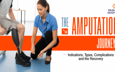 The Amputation Journey: Indications, Types, Complications and the Recovery