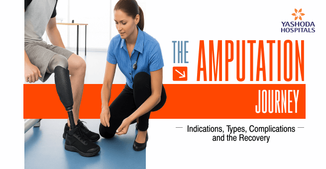 Amputation Main Banner