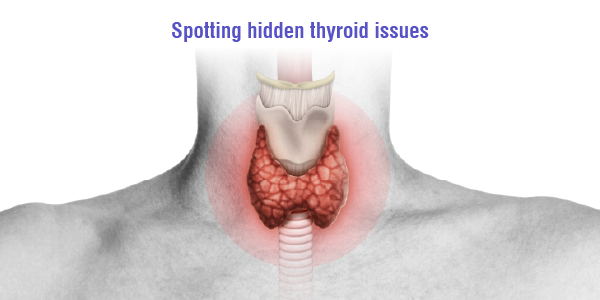 Spotting hidden thyroid issues