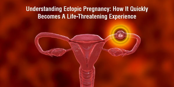 Understanding Ectopic Pregnancy