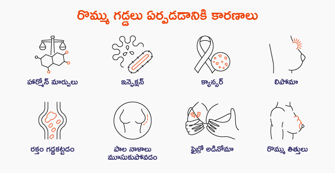 Causes of breast lumps types
