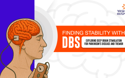 Finding Stability with DBS: Exploring Deep Brain Stimulation for Parkinson’s Disease and Tremor