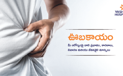 ఊబకాయం: మీ ఆరోగ్యంపై దాని ప్రభావం, కారణాలు, నివారణ మరియు జీవనశైలి మార్పులు
