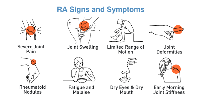 Rheumatoid arthritis Symptoms
