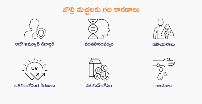 Vitiligo Main Banner