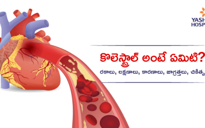 కొలెస్ట్రాల్ అంటే ఏమిటి? రకాలు, లక్షణాలు, కారణాలు, జాగ్రత్తలు, చికిత్స