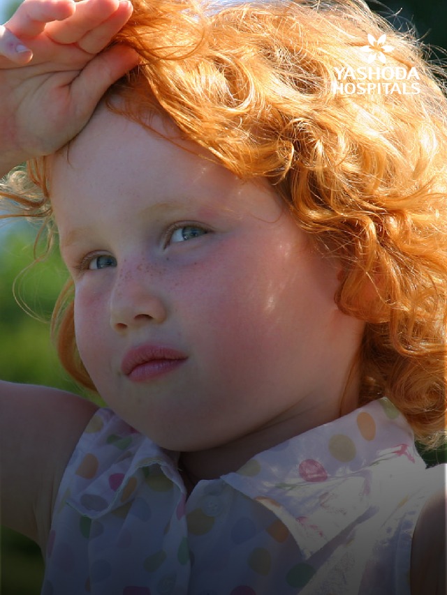 heat stroke kids slide 4