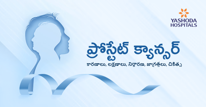 ప్రోస్టేట్ క్యాన్సర్: కారణాలు, లక్షణాలు, నిర్ధారణ, జాగ్రత్తలు, చికిత్స