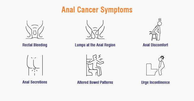 Anal Cancer