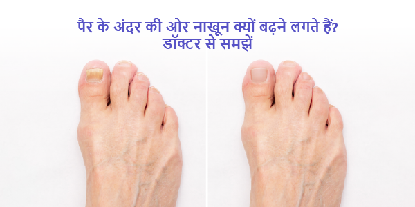 Why is my nail so thick- Doctor