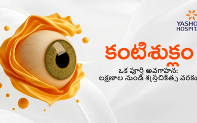 కంటిశుక్లం – ఒక పూర్తి అవగాహన: లక్షణాల నుండి శస్త్రచికిత్స వరకు