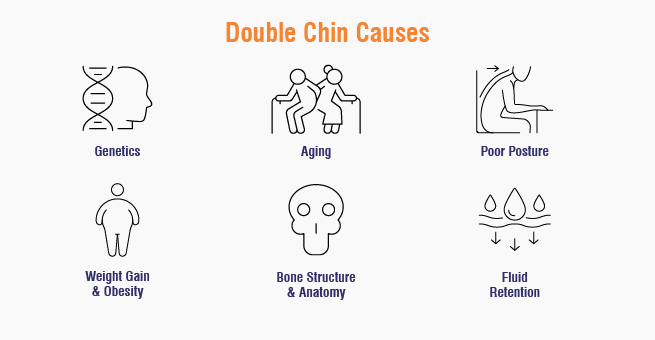 Double chin