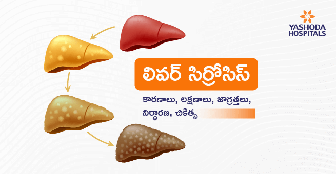Liver cirrhosis Telugu Main Banner