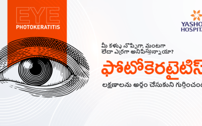 మీ కళ్ళు నొప్పిగా, మంటగా లేదా ఎర్రగా అనిపిస్తున్నాయా? ఫోటోకెరటైటిస్ లక్షణాలను అర్థం చేసుకుని గుర్తించండి!