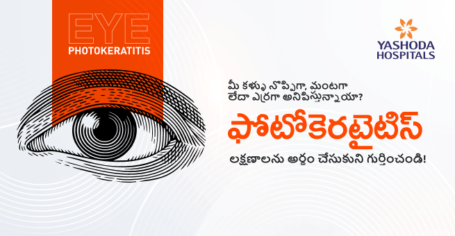 Photokeratitis Main Telugu Banner