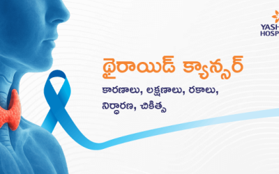 థైరాయిడ్ క్యాన్సర్, కారణాలు, లక్షణాలు, రకాలు, నిర్ధారణ, చికిత్స