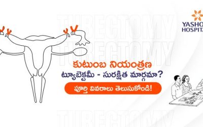 కుటుంబ నియంత్రణ: ట్యూబెక్టమీ – సురక్షిత మార్గమా? పూర్తి వివరాలు తెలుసుకోండి!
