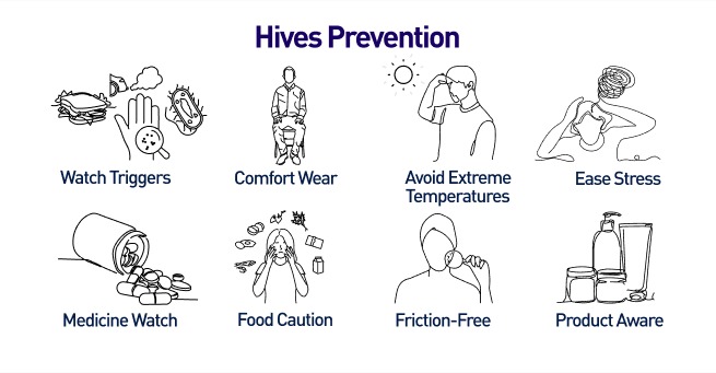 hives Prevention