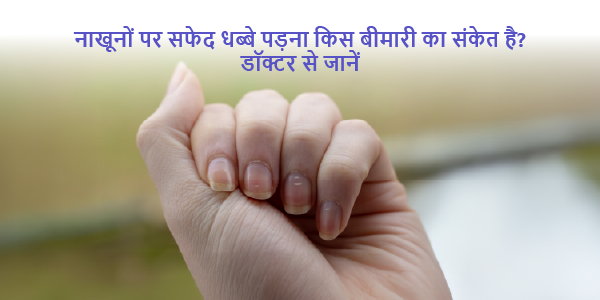 What disease is the sign of white spots on the nails- Learn from the doctor