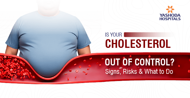 High cholestrol_Main Banner