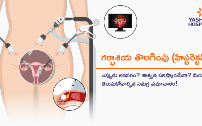గర్భాశయ తొలగింపు (హిస్టరెక్టమీ): ఎప్పుడు అవసరం? శాశ్వత పరిష్కారమేనా? మీరు తెలుసుకోవాల్సిన సమగ్ర సమాచారం!