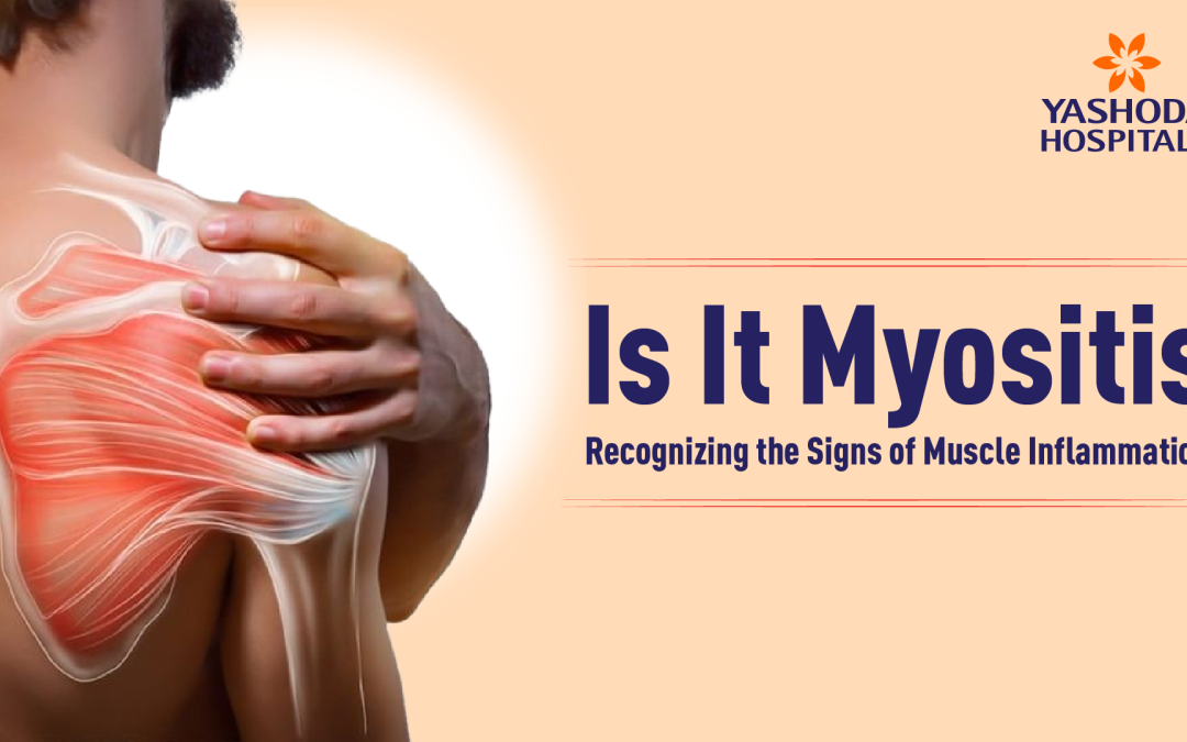 Is It Myositis? Recognizing the Signs of Muscle Inflammation