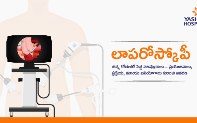 లాపరోస్కోపీ: చిన్న కోతలతో పెద్ద పరిష్కారాలు – ప్రయోజనాలు, ప్రక్రియ, మరియు వినియోగాలు గురించి వివరణ