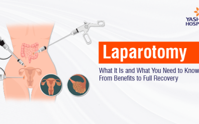 Laparotomy: What It Is and What You Need to Know—From Benefits to Full Recovery