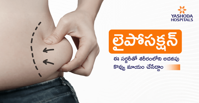 Liposuction Telugu Main Banner