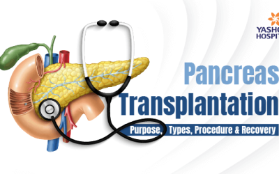 Pancreas Transplantation: Purpose, Types, Procedure & Recovery