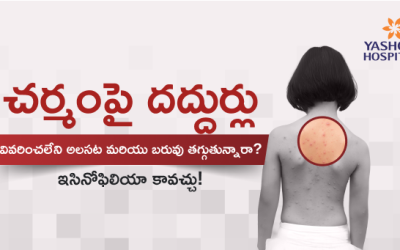 చర్మంపై దద్దుర్లు, వివరించలేని అలసట మరియు బరువు తగ్గుతున్నారా? ఇసినోఫిలియా కావచ్చు!