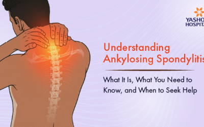 Understanding Ankylosing Spondylitis: What It Is, What You Need to Know, and When to Seek Help