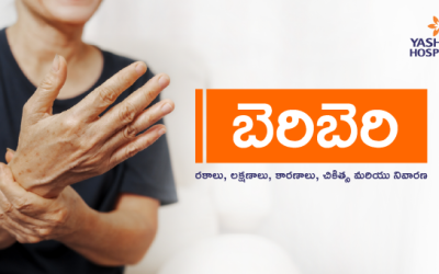 బెరిబెరి: రకాలు, లక్షణాలు, కారణాలు, చికిత్స మరియు నివారణ