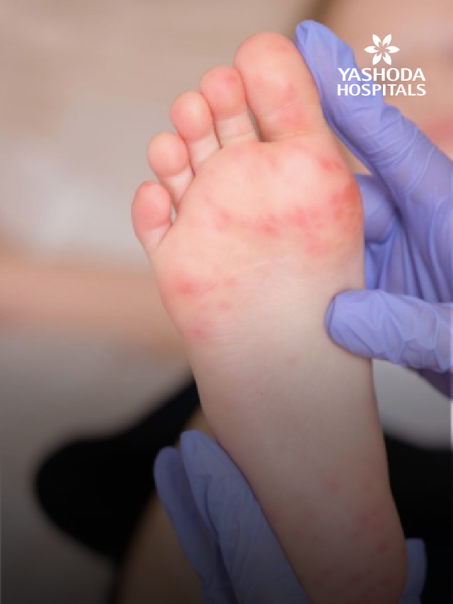 hand foot mouth title slide