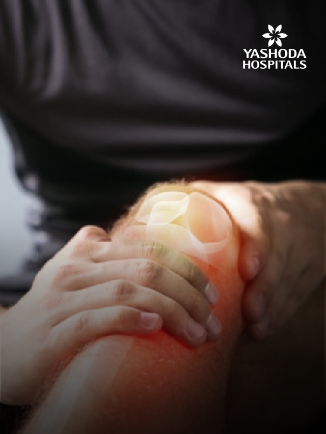 Bone Fractures banner