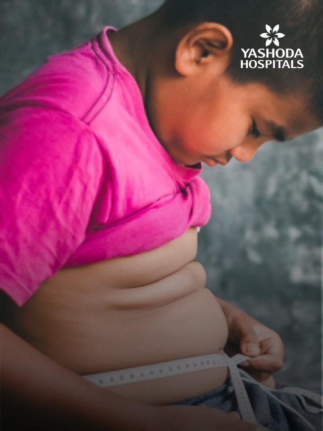 Childhood Obesity banner