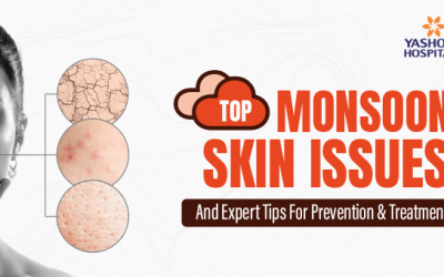 Top Monsoon Skin Issues and Expert Tips for Prevention & Treatment