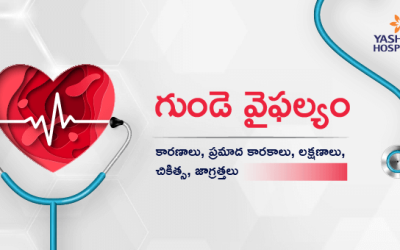 గుండె వైఫల్యం : కారణాలు, ప్రమాద కారకాలు, లక్షణాలు, చికిత్స, జాగ్రత్తలు