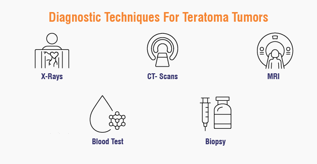 Teratoma Tumors